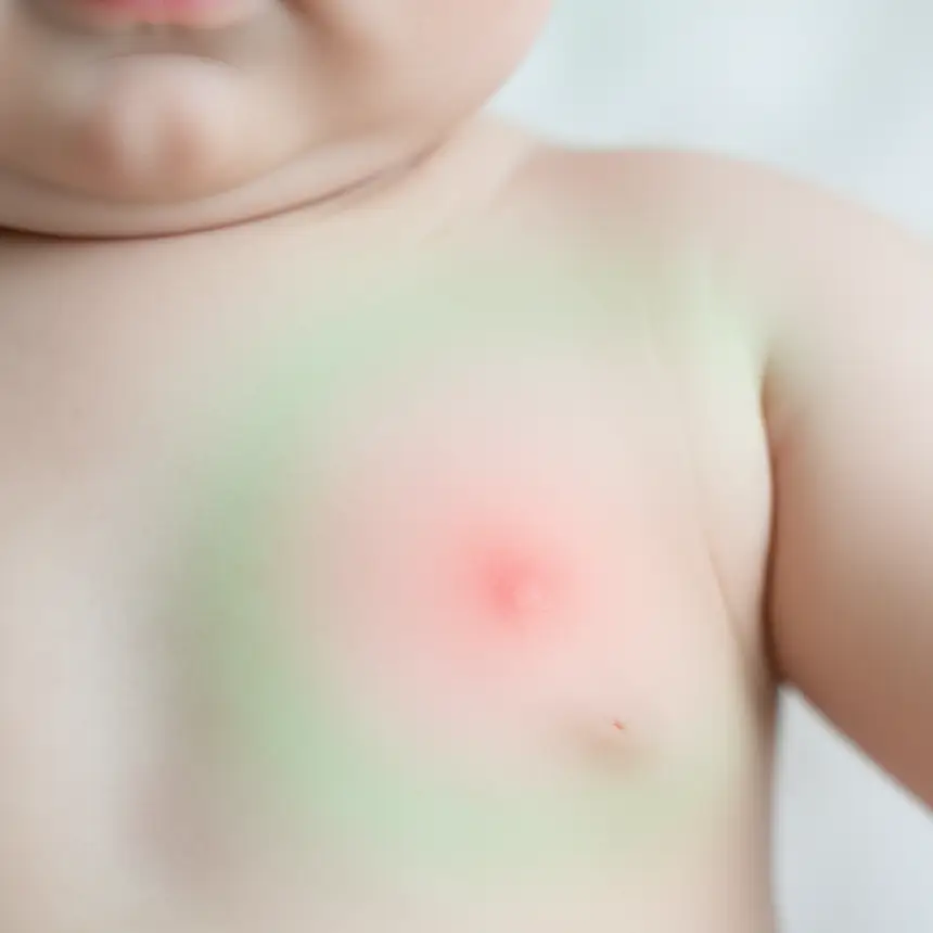 Baby skin, skin barrier, dryness